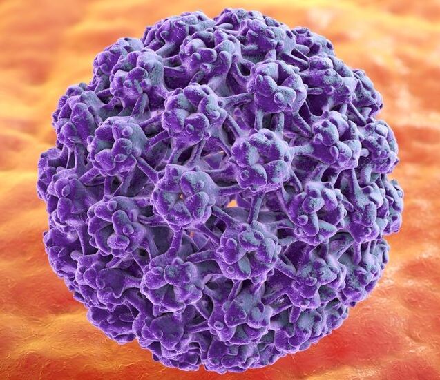 HPV 导致手上的疣的 3D 模型